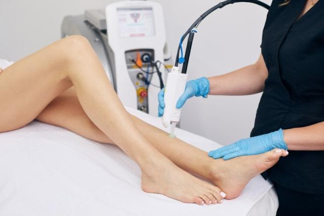 épilation laser